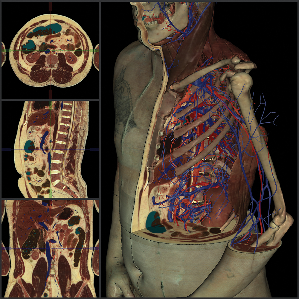 VH Dissector Quizzes: Master Anatomy with Interactive Quizzes