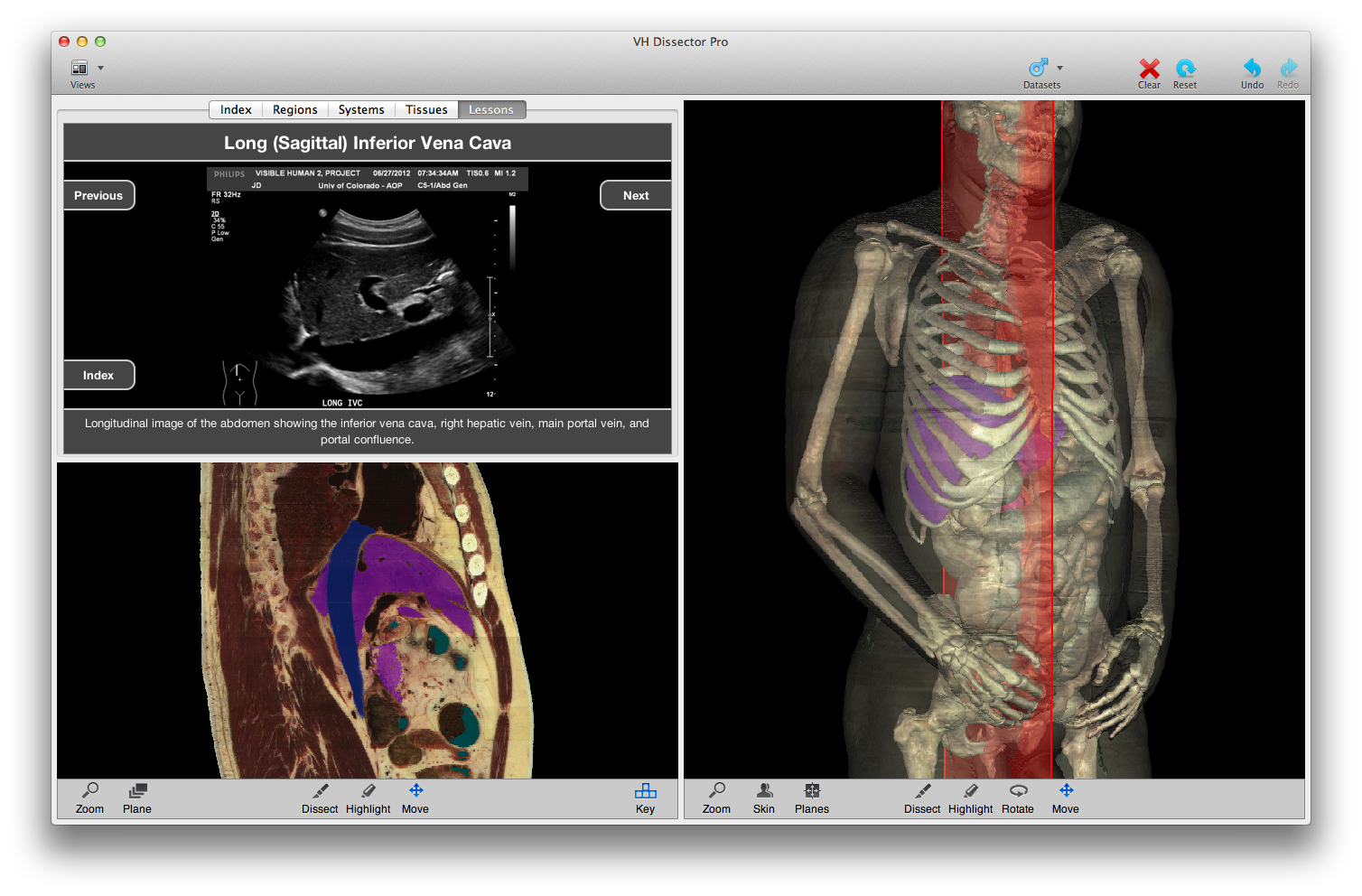 VH Dissector Quizzes: Master Anatomy with Interactive Quizzes