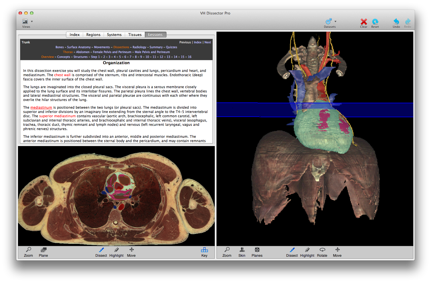 VH Dissector Quizzes: Master Anatomy with Interactive Quizzes